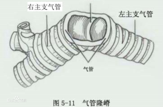 气管隆嵴