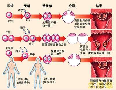 半同卵双生