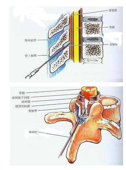 蛛网膜下腔