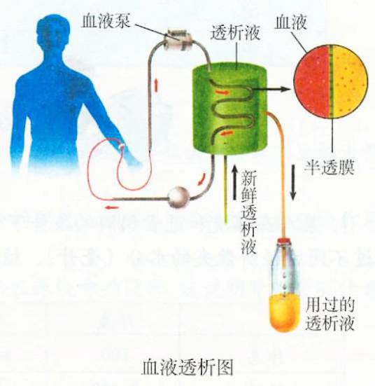 连续肾脏替代治疗