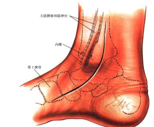 脚内踝