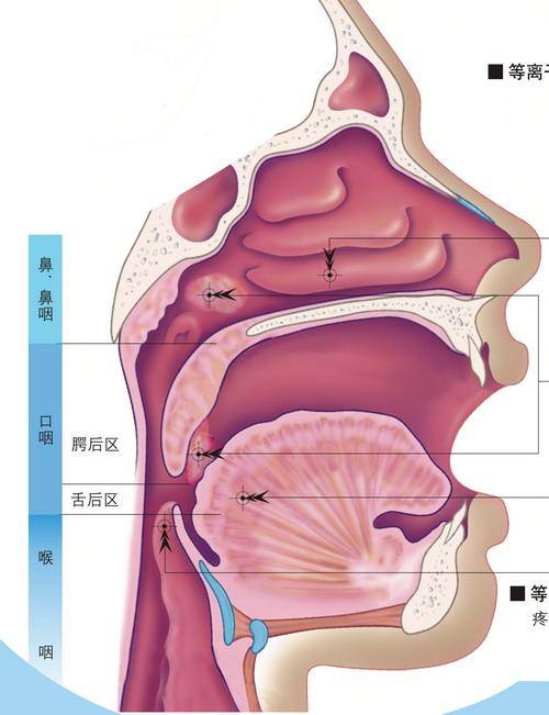 咽鼓管堵塞